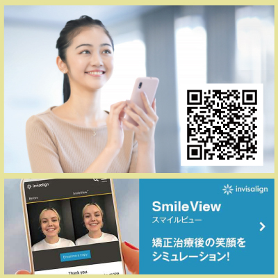 スマイルビューで矯正後の笑顔をシミュレーション