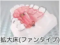 FANタイプ拡大