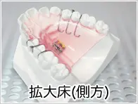 側方拡大